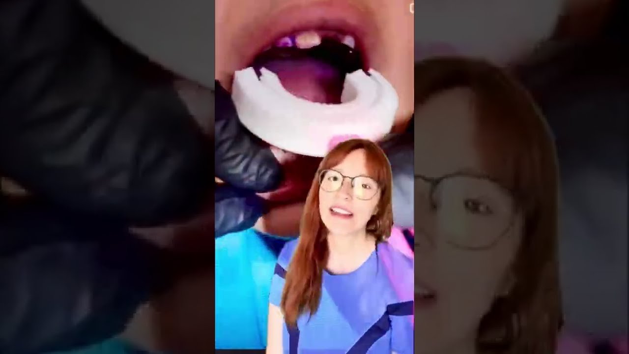 Cepillos dentales inalámbricos ecológicos: datos interesantes Secretos revelados