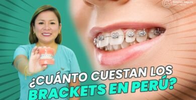 Cuánto cuesta un tratamiento de ortodoncia en Perú