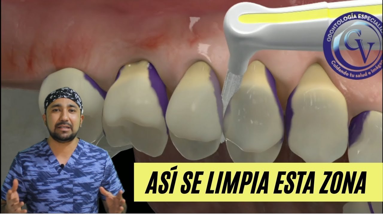 Curiosidades sobre la limpieza interdental con cepillos inalámbricos Secretos revelados