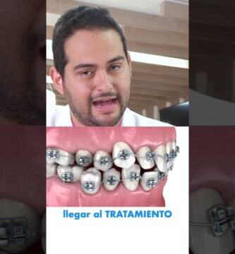 Duración promedio de un tratamiento de ortodoncia con brackets